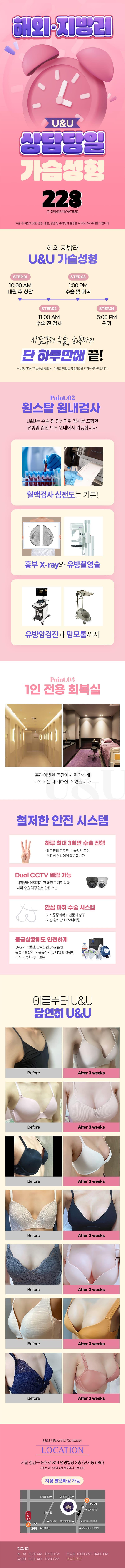 유앤유성형외과의원의 U&U 상담 당일 가슴성형 서비스는 해외 지방러들을 위한 볼륨있는 가슴을 원하는 분들을 위한 228만원의 가격으로 제공되는 특별한 성형 상품입니다.