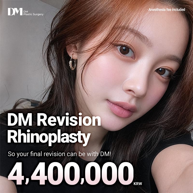 DM Rhinoplasty Revision