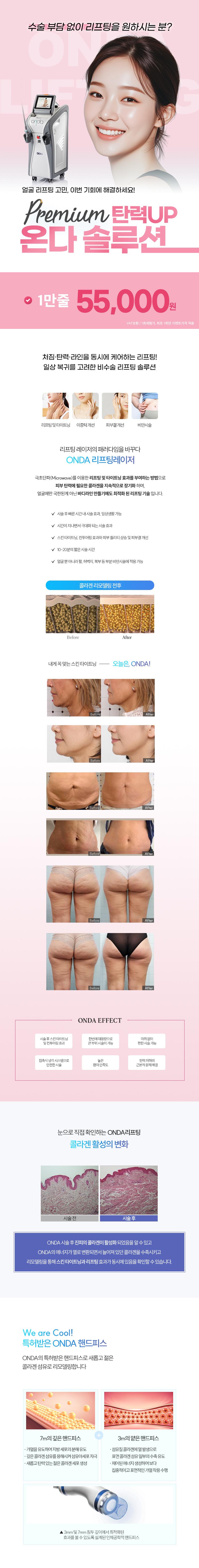 서울 압구정 비더뉴의원에서 제공하는 비더뉴_리프팅온다는 온다리프팅을 이용한 피부시술을 제공합니다.