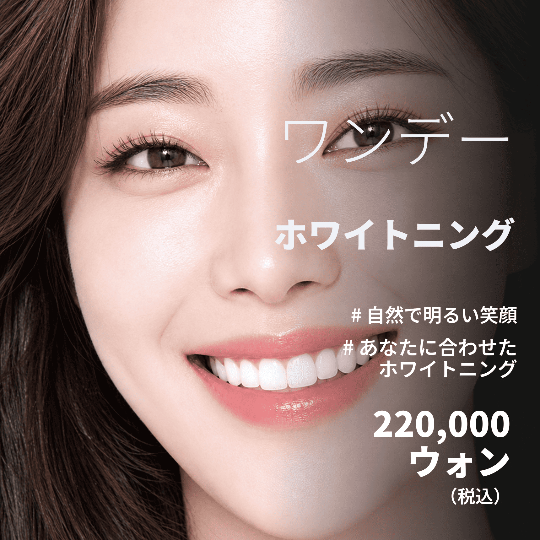 ワンデー カスタムホワイトニング 2回