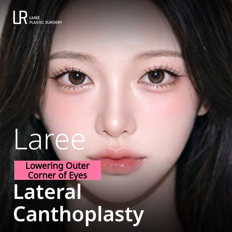 LAREE Lateral Canthoplasty