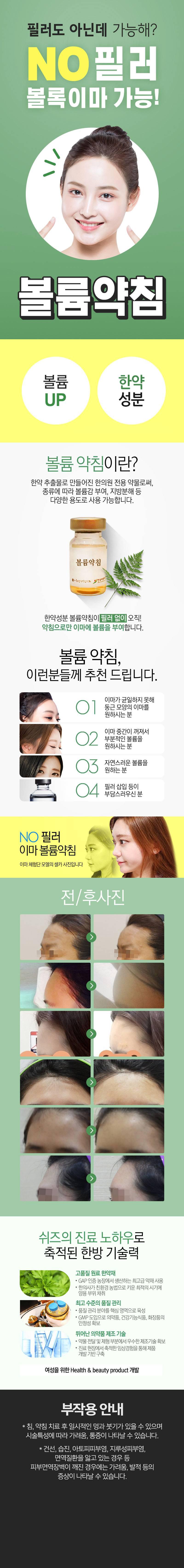 쉬즈한의원 강남점의 NO필러 이마 볼륨약침 시술로 자연스러운 이마라인 교정 (16.5만원)