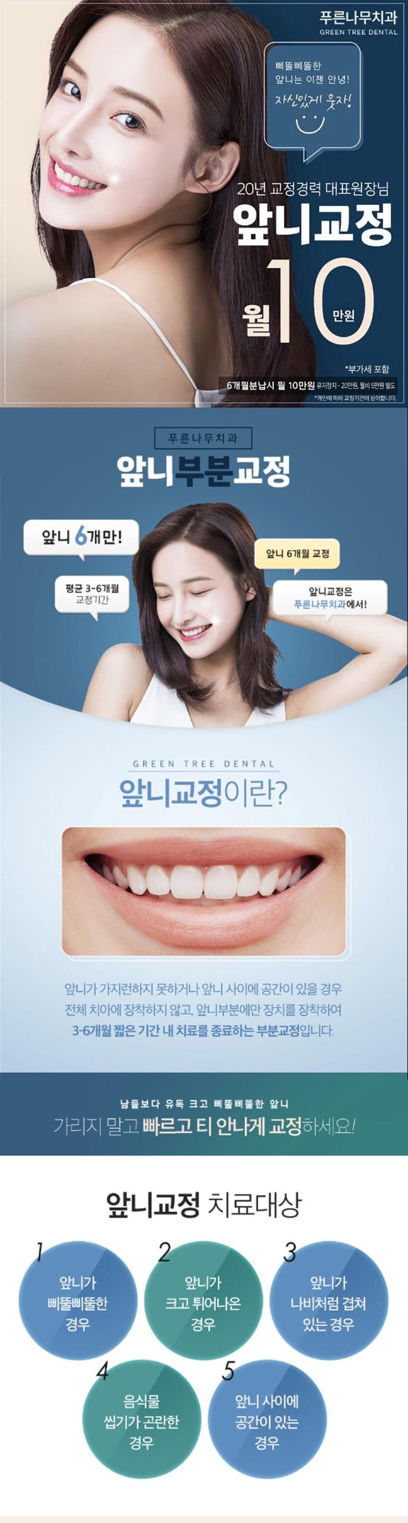 강남역 푸른나무치과의 9만원 앞니교정 시술: 3-6개월 짧은 기간 내 삐뚤삐뚤한 앞니 교정