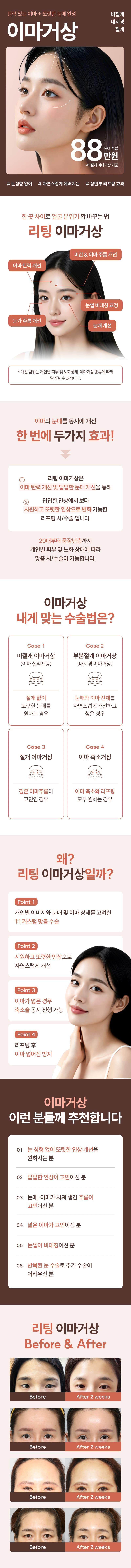 리팅성형외과의원 강남점에서 제공하는 탄력있는 이마, 이마거상 시술로 매끈하고 또렷한 눈매를 완성하세요.