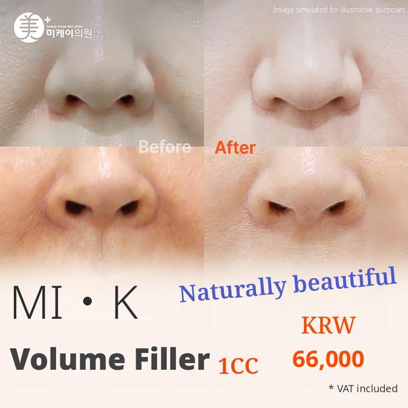 MI·K Volume Filler 1cc