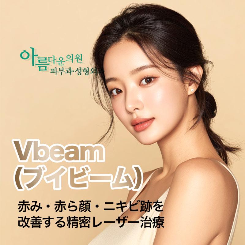 Vbeam（ブイビーム）