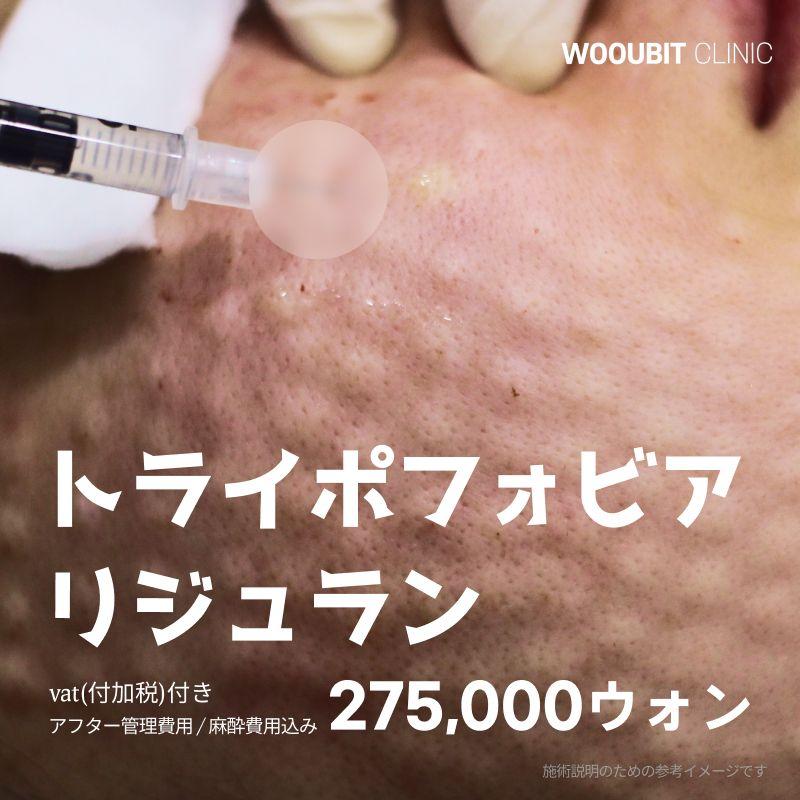 集合体恐怖症のリジュラン