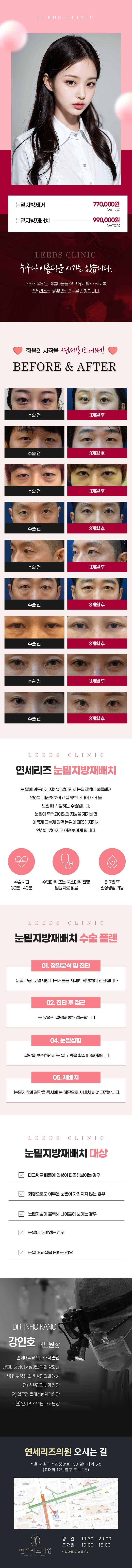 연세리즈의원의 반짝 눈밑지방제거/재배치 시술을 통해 눈밑의 고민을 해결하세요.