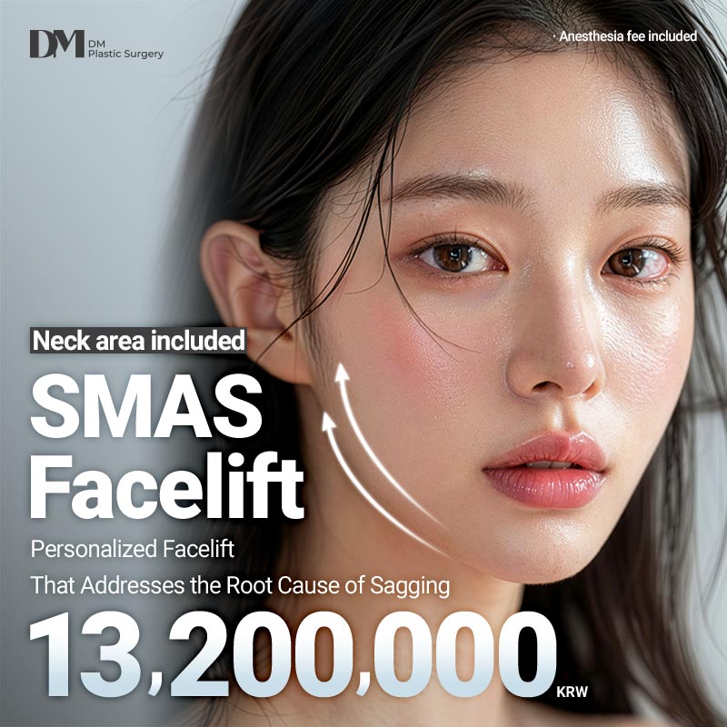 DM SMAS Facelift