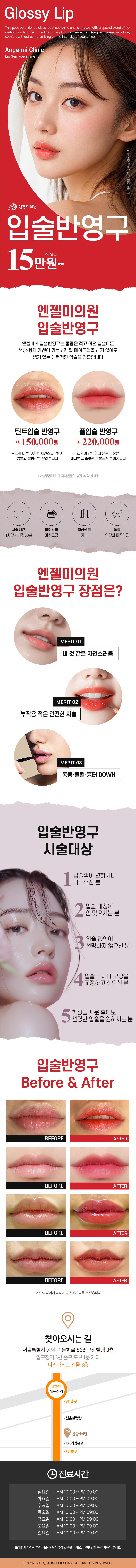 서울 압구정 엔젤미의원의 상큼발랄한 입술 반영구 시술 (15만원) - 자연스럽고 또렷한 입술색 연출