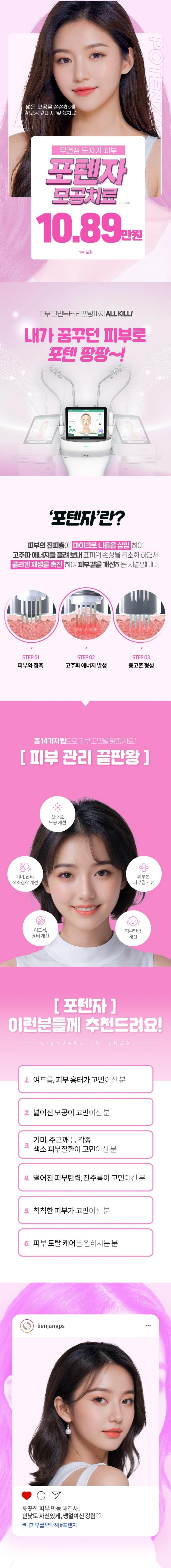 리엔장의원 인천점의 모공/피지 집중 관리 프로그램 '포텐자' 108,900원 특가 이벤트