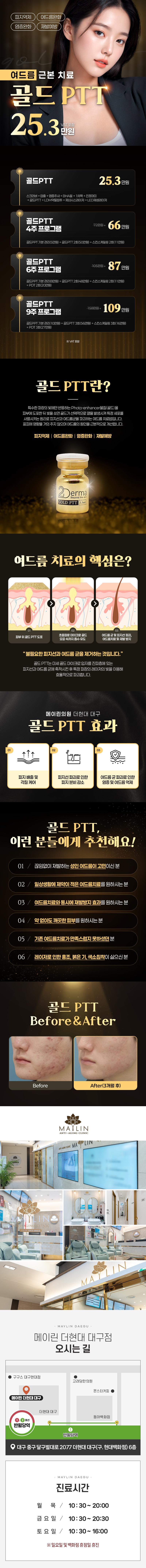 대구 동성로 메이린의원의 골드PTT 시술은 여드름 균과 피지선 제거로 근본적인 여드름 치료를 제공하는 25.3만원 특화 프로그램입니다.