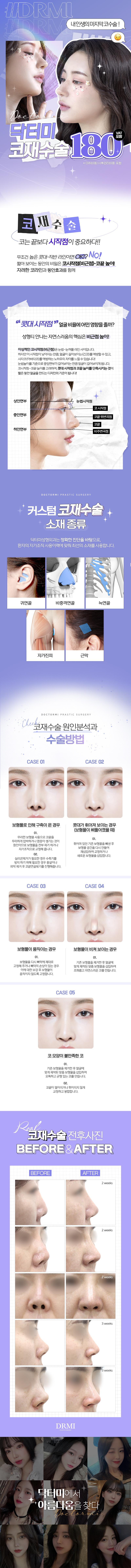 강남역 닥터미성형외과의 180만원 맞춤형 코재수술 프로모션으로, 코수술 부작용 및 불만족 사례에 대한 개인별 맞춤 해결방안 제공