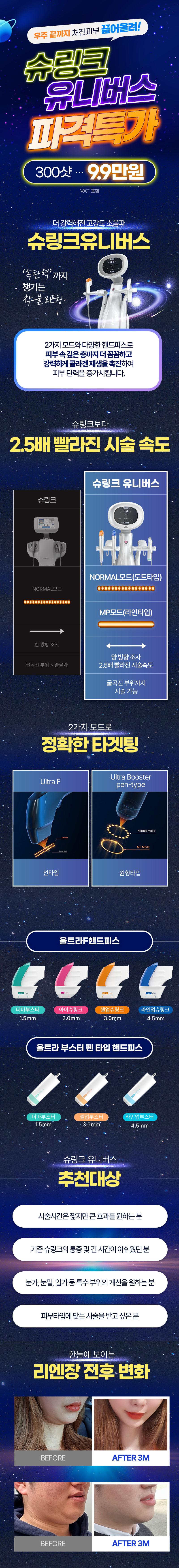 슈링크 유니버스 첨단 리프팅 시술로 2.5배 빨라진 속도와 강력한 효과를 제공하는 특가 프로모션