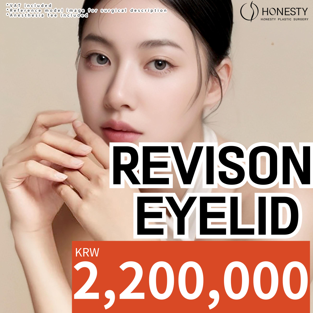 HONESTY Revision Double Eyelid Surgery