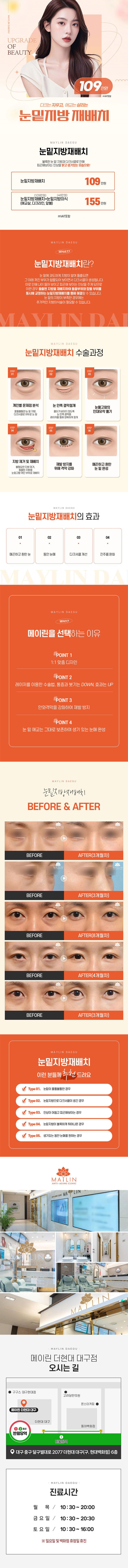 메이린의원(대구점)의 대구 눈밑지방재배치는 재발 확률을 낮춘 격막강화 눈밑지방 처리로 다크서클과 울퉁불퉁한 눈 밑 지방을 개선합니다.