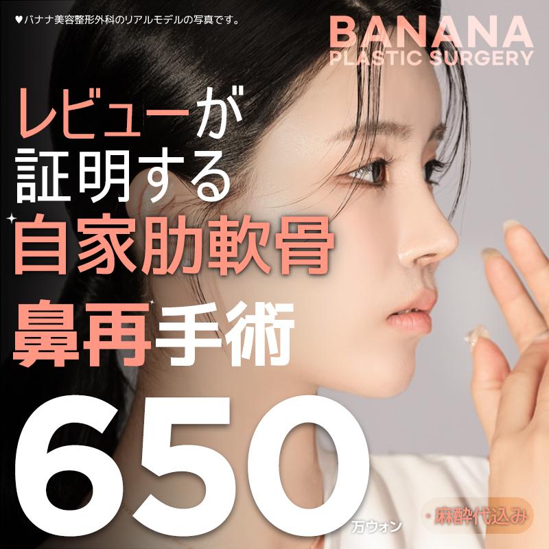 レビューが証明する自家肋軟骨使用の鼻再手術