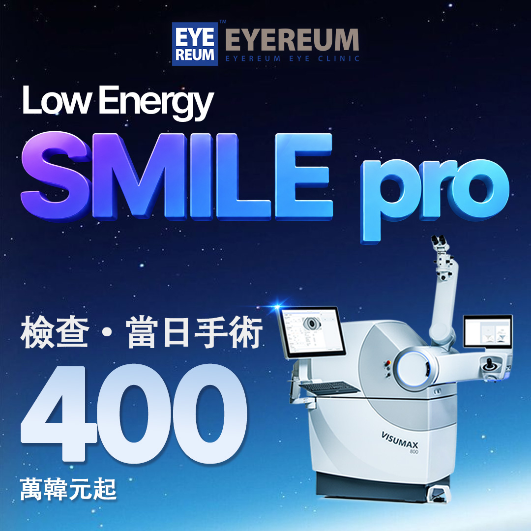 Low Energy SMILE pro 檢查當日手術