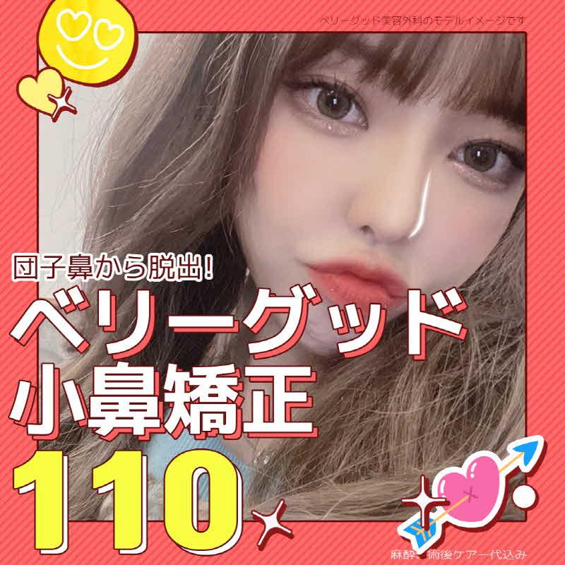 ベリーグッド　小鼻矯正