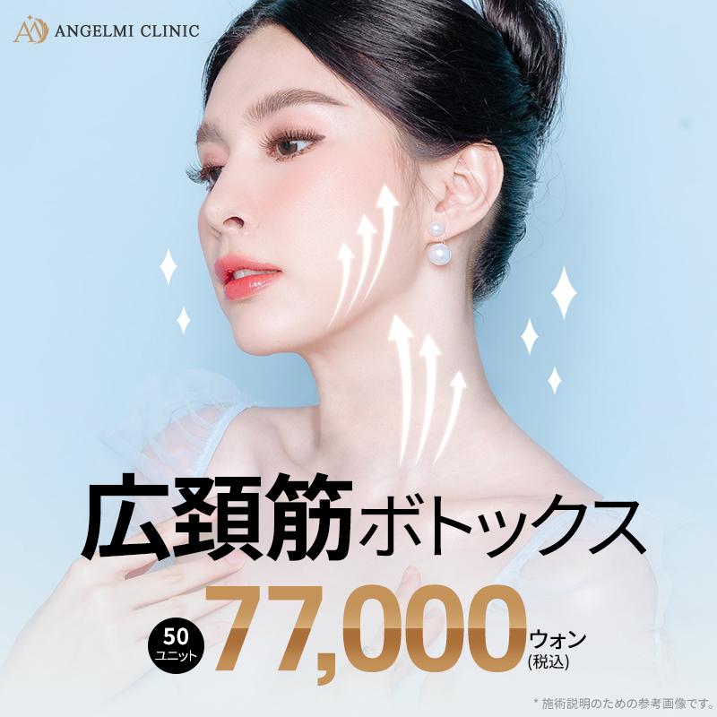 広頚筋 ボトックス
