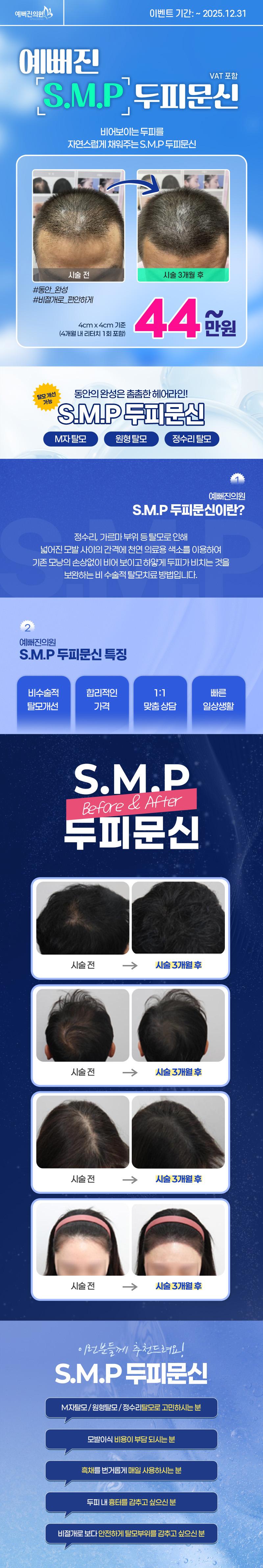 예뻐진의원의 SMP 두피문신 시술로 M자탈모, 원형탈모, 정수리탈모를 자연스럽게 해결하는 44만원 특가 프로모션