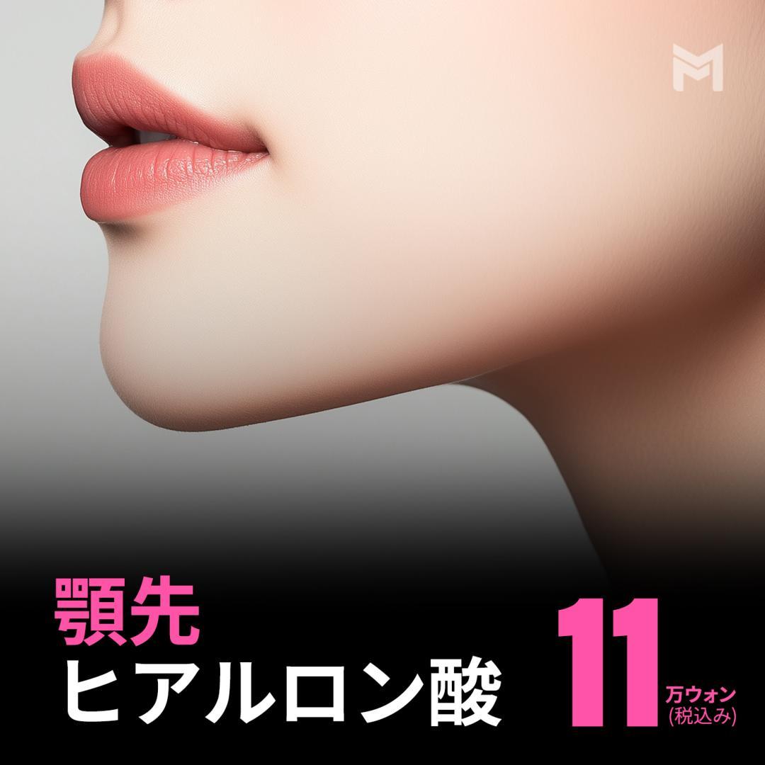 顎先ヒアルロン酸注入