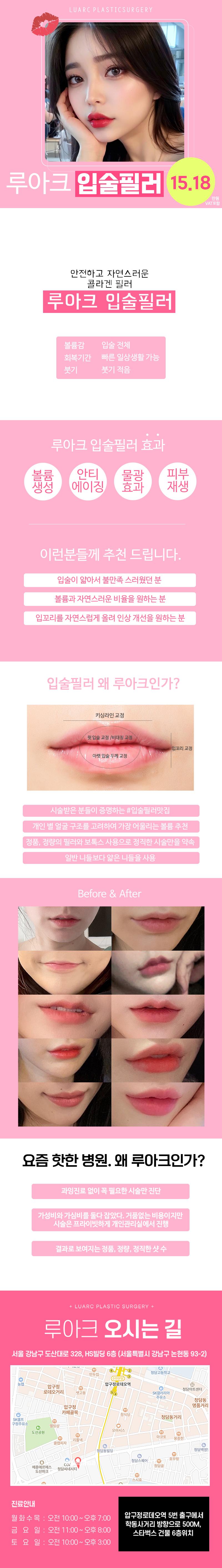 서울 압구정에 위치한 루아크성형외과의원에서 제공하는 루아크 입술필러는 입술에 볼륨을 주고 얇은 입술을 개선하는 효과를 제공합니다.