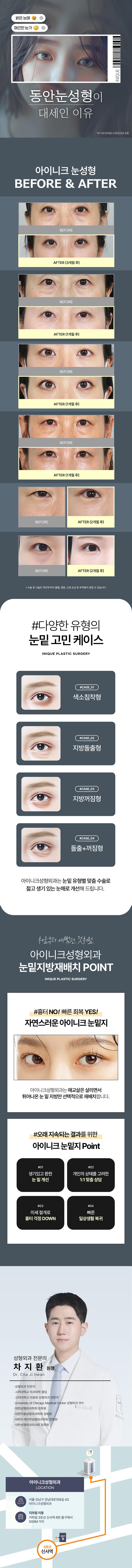 아이니크성형외과의 눈밑지방재배치 시술로 다크서클과 볼록한 눈밑을 개선하여 젊고 생기있는 눈매로 변화