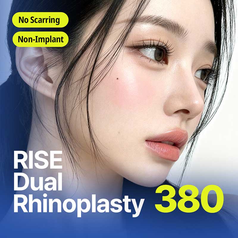 Rise Dual Rhinoplasty – No Implant Extra Charge