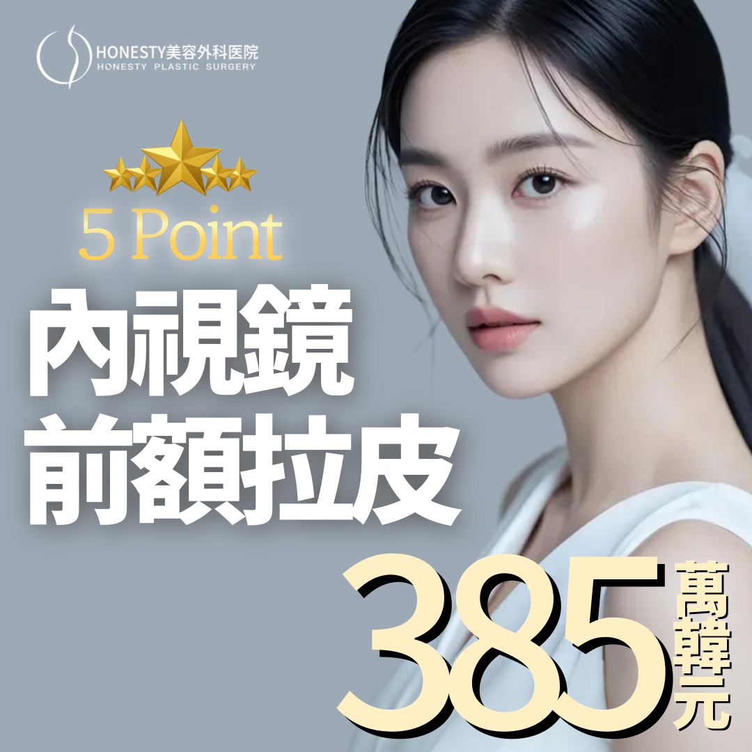 內窺鏡 5POINT 額頭拉提