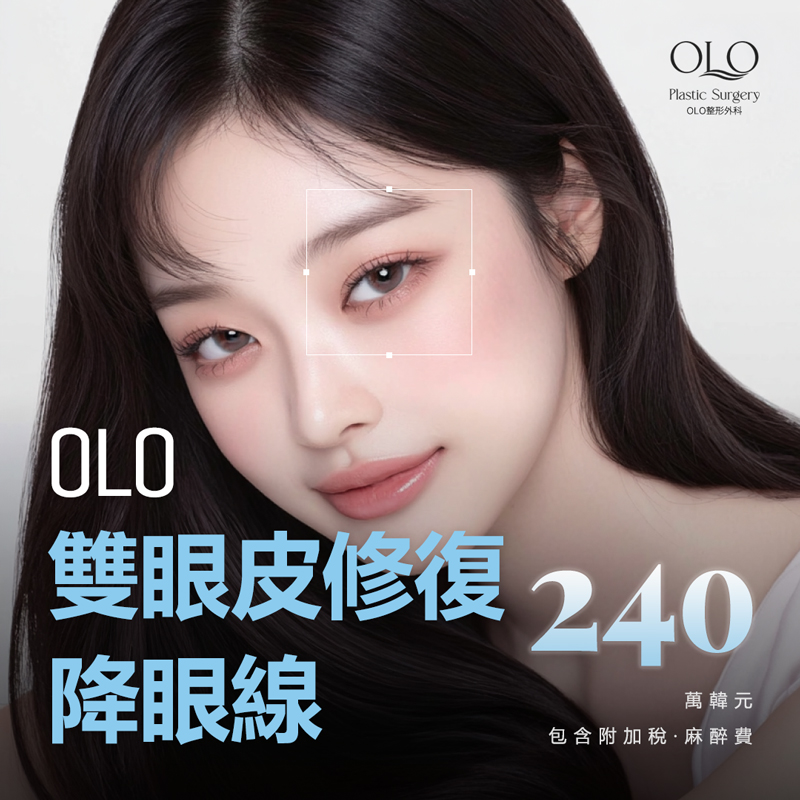 OLO 雙眼皮修復降眼線