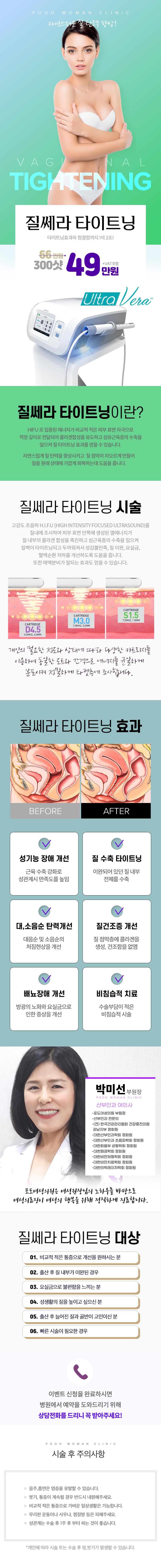 강남역 인근 강남포도여성의원의 여의사가 직접 시술하는 질쎄라 타이트닝 시술 (49만원)