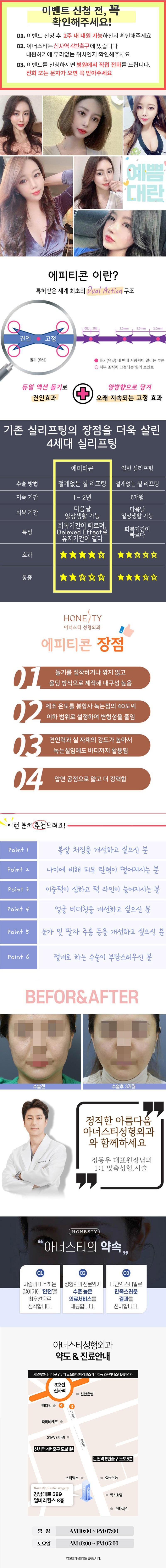 아너스티성형외과의 에피티콘 실리프팅은 울퉁불퉁한 얼굴 라인과 처진 얼굴 라인을 개선하는 성형 시술입니다.