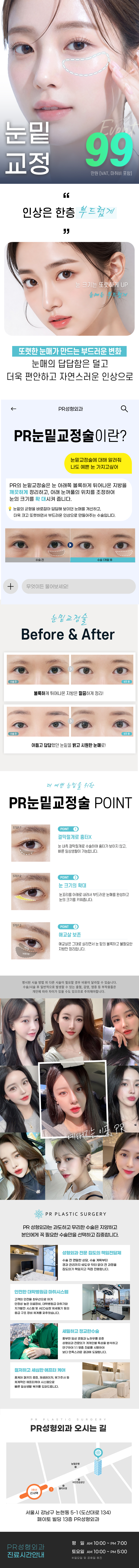 피알성형외과의원에서 제공하는 하루 눈밑 교정 달라진 눈밑지 서비스