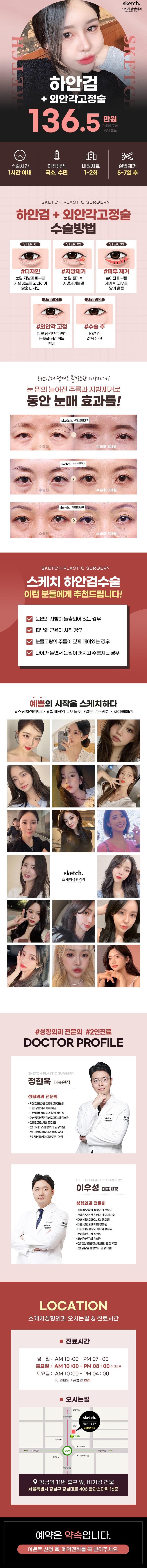 강남역 스케치성형외과의 하안검 수술로 다크써클, 처진눈밑, 눈밑지방 돌출 개선 (136.5만원)