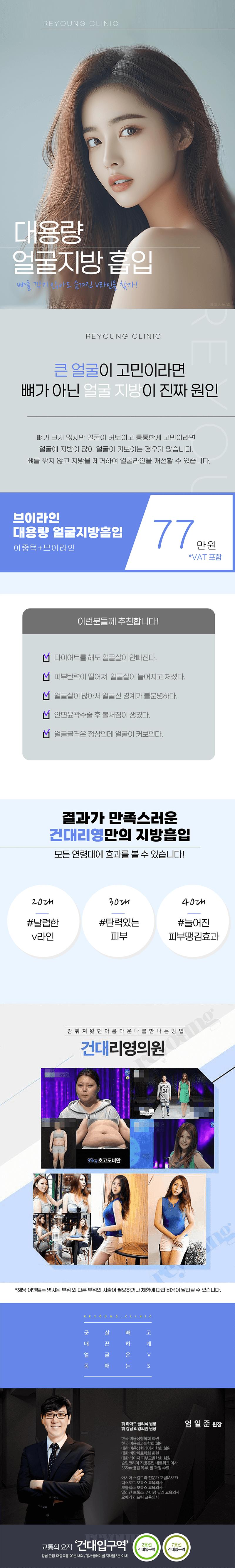건대 리영의원의 77만원 대용량 얼굴지방흡입 시술로 날렵한 브이라인 완성