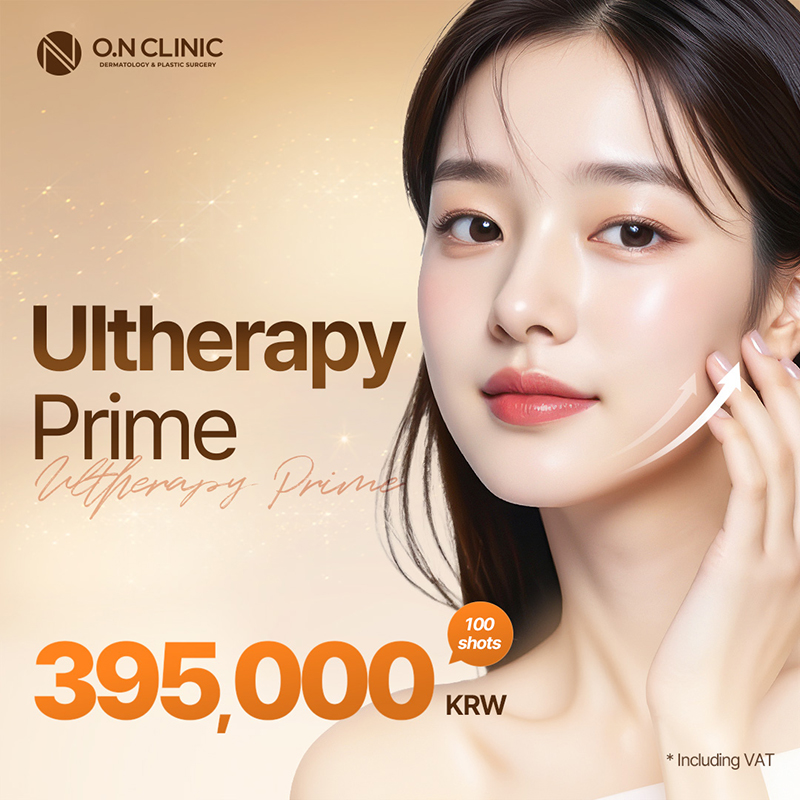 Ultherapy Prime