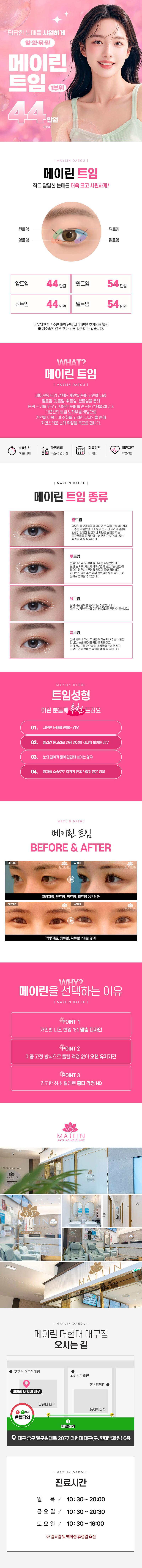 대구 동성로 메이린의원의 44만원 트임성형 시술 패키지로, 다양한 눈매 교정이 가능한 맞춤형 눈성형 프로그램