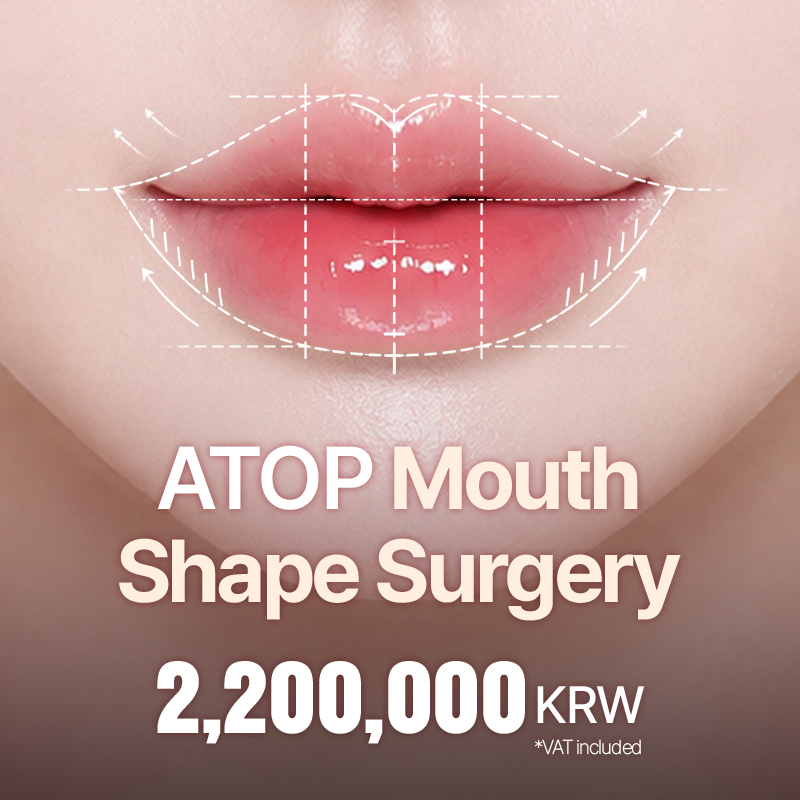 ATOP Lip Surgery_Lip Corner Lift, Philtrum Reduction, Philtrum Groove Surgery