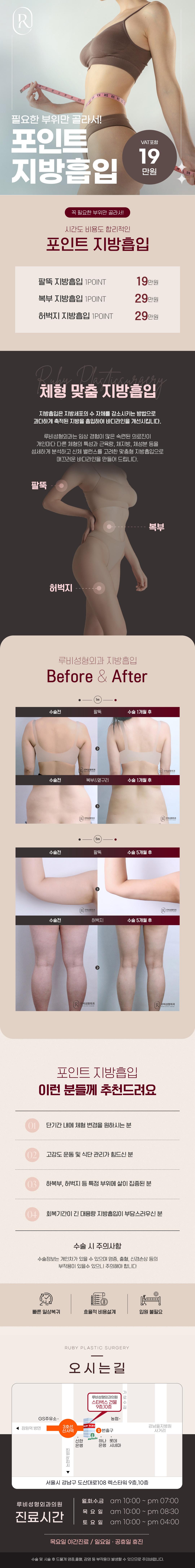 루비성형외과의원에서 원하는 부위만 포인트 지방흡입 서비스를 제공합니다. 단기간 내에 체형 변경을 원하시는 분을 대상으로 하며, 4부위 이상 시 마취비 무료입니다.
