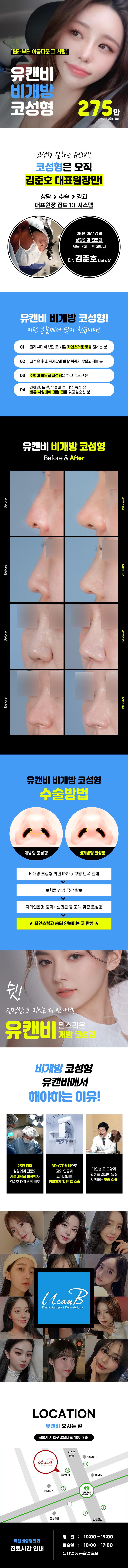 강남역 유캔비성형외과의 비개방 코성형 시술로, 흉터 걱정 없이 자연스러운 코 교정이 가능한 275만원 프로모션