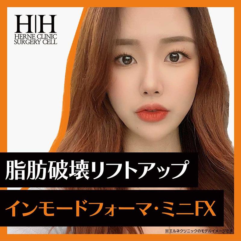 インモードフォーマorミニFX