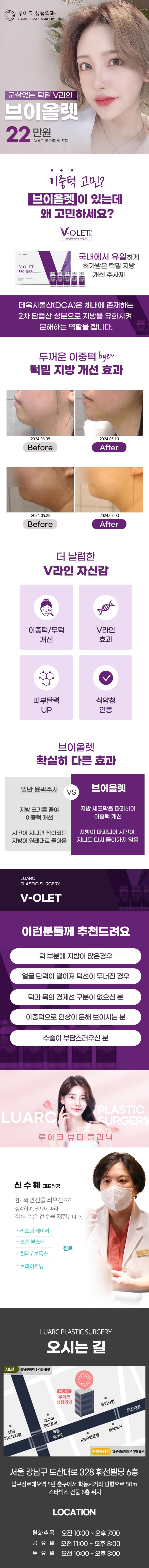 루아크성형외과에서 22만원에 식약처 허가를 받은 이중턱 소멸에 효과적인 V라인 브이올렛 성형을 제공합니다.