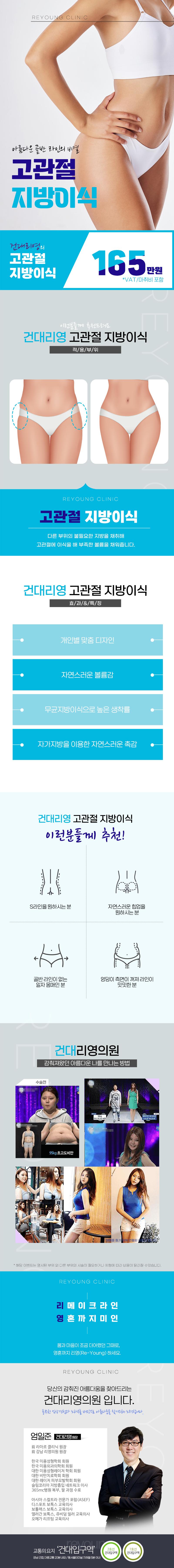 건대 리영의원의 165만원 고관절 지방이식 시술로 자연스러운 S라인 골반 라인 형성