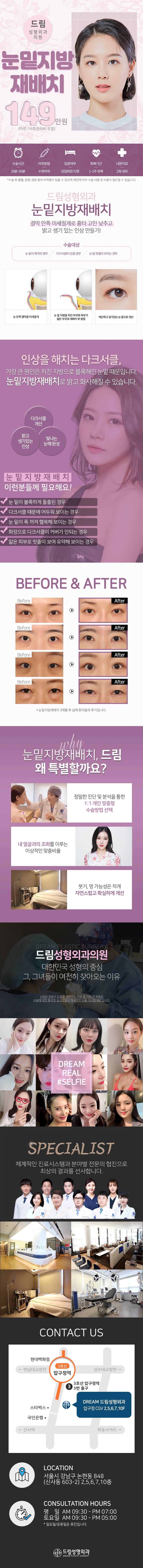 드림성형외과의 149만원 눈밑지방재배치 시술로 울퉁불퉁한 눈밑과 다크서클 개선