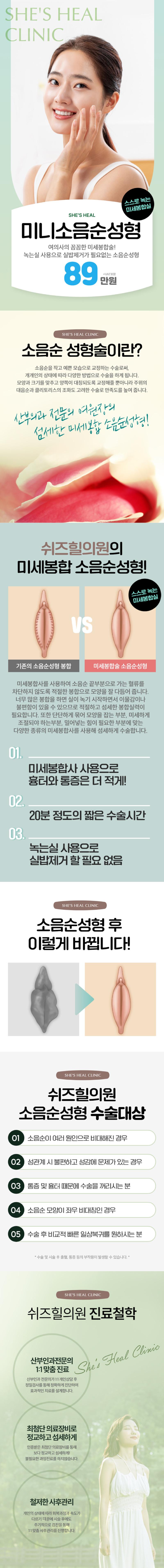 서울 신사 쉬즈힐의원에서 제공하는 쉬즈힐 핑크 소음순수술은 녹는실을 사용하여 실밥 제거가 필요없는 쉬즈힐의 꼼꼼한 미세봉합술로, 가격은 89만원입니다.