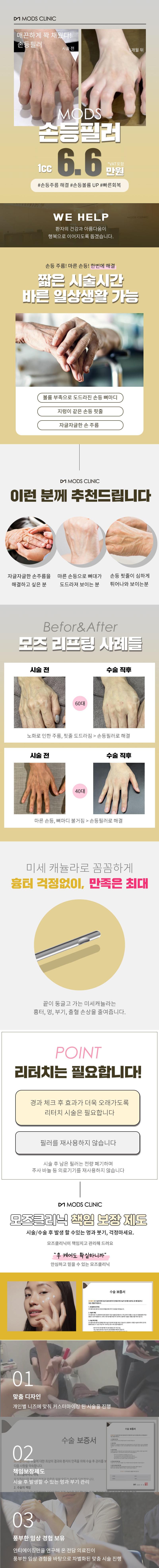 서울 청담 모즈의원의 이물감없는 손등필러는 손등 주름과 마른 손등, 손등 핏줄 노출 문제를 해결하고 손등 볼륨을 향상시키는 특화된 시술입니다.