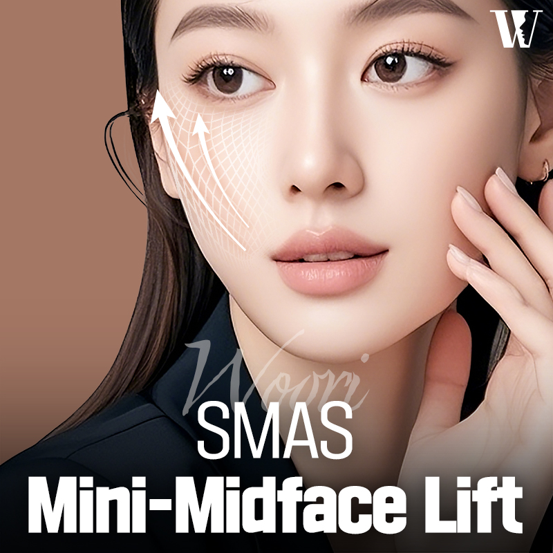 Trusted SMAS Facelift Mini-Midface Lift