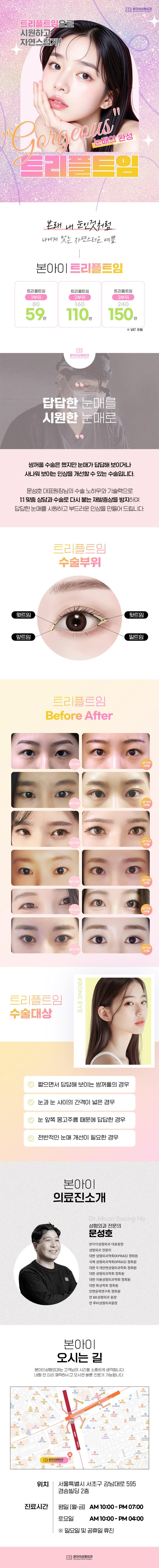 본아이성형외과의 트리플트임 시술로 시원하고 자연스러운 눈매 완성 (59만원)