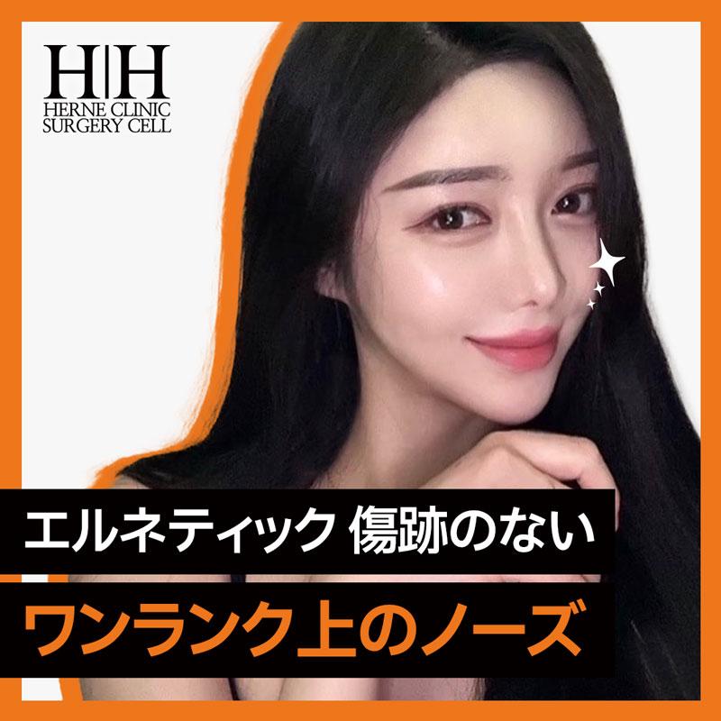 切らリフトない鼻整形ノーズスレッド